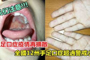 手足口症疫情再擴散全國12州手足口症超過警戒水平