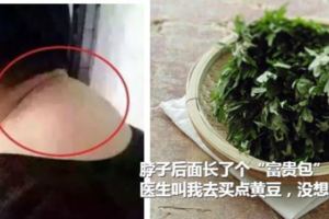 【脖子後面長了個富貴包】中醫叫我去買點黃豆，沒想到竟然治好了