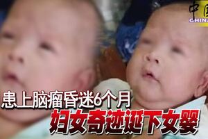 患上腦瘤昏迷6個月婦女奇跡誕下女嬰