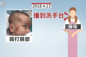 男嬰洗澡三度燙傷保母挨告辯「不知水燙」