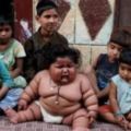 驚！印度1歲女娃每天喝母乳23次竟長成20公斤巨嬰