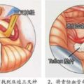 「牙疼不算病」真疼起來要人命，三叉神經作怪名醫妙手祛除老牙痛