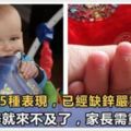 孩子有這5種表現，已經缺鋅嚴重，再不補鋅就來不及了家長需重視