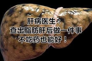 肝病醫生：查出脂肪肝後做一件事，不吃藥也能好！