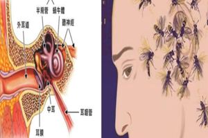 耳鼻喉科主任：耳鳴是救命的警鈴！90%能治好