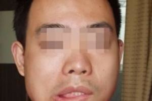 小夥子一覺來睡醒嘴歪眼斜，就因為沒注意一件小事