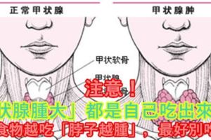 注意！「甲狀腺腫大」都是自己吃出來的！7種食物越吃「脖子越腫」，最好別吃了！