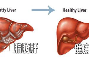 最傷肝的5種食物,一吃就傷肝,告訴家人要少吃!