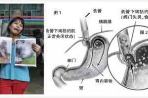 男孩在午睡中窒息離世，為了孩子安全，你得知道什麼是食物倒流