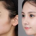 19個證明「不必重新投胎也能變臉重生」的韓國女人整形例子！