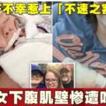 剖腹產不幸惹上「不速之客」女下腹肌壁慘遭吃光光！