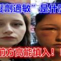 「染髮​​劑過敏」是什麼鬼？前方高能慎入！！