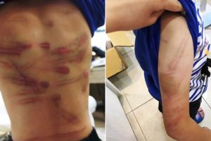 可以給我喝杯水嗎？　７歲男童滿身傷，父親女友打的，同為人母的護理師看到當場流淚，男童被打時　父親竟邊流眼淚邊打遊戲.....