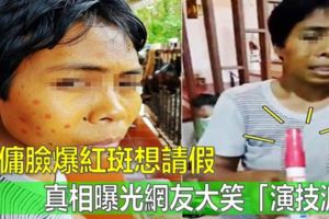 外傭臉爆紅斑想請假　真相曝光網友大笑「演技派」
