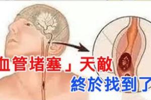 「血管堵塞」天敵終於找到了！每天吃一點，將血管清掃得不堵不硬！