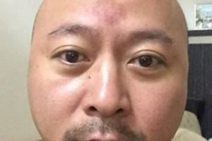 台灣一女子吃到頭髮要退錢老闆神回覆：我沒有頭髮啊