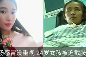 一場感冒引發病毒性心肌炎24歲女孩右腿被迫截肢