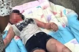17歲少女午睡被人用開水灌進嘴裡警方通報：嫌疑人已被控制