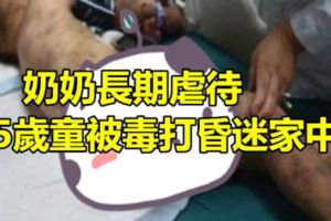 奶奶長期虐待5歲童被毒打昏迷家中