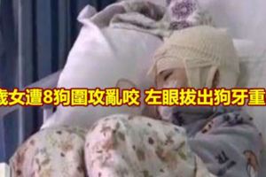 8歲女遭8狗圍攻亂咬左眼拔出狗牙