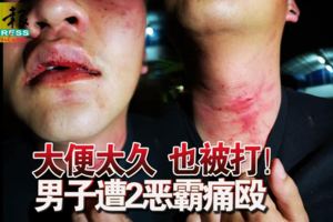 大便太久也被打！男子遭2惡霸痛毆