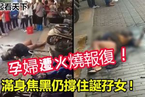 【極度凶殘】27歲孕婦遭火燒報復,躺地抽蓄!滿身焦黑仍撐住誕孖女!