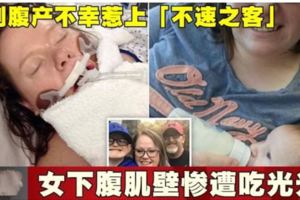 剖腹產不幸惹上「不速之客」女下腹肌壁慘遭吃光光！