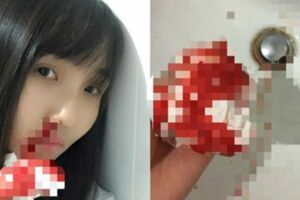 毒霧霾超恐怖！正妹流鼻血染紅口罩 