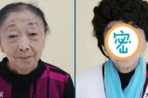 71歲阿嬤為了嫁給年輕帥哥，花光所有財產跑去「整型成17歲少女」模樣曝光，嚇壞全網！