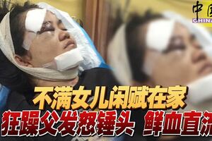 不滿女兒閒賦在家狂躁父發怒錘頭鮮血直流