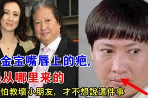 洪金寶一直羞以開口，嘴唇上的疤其實是他的風流債，那時年輕氣盛不懂事