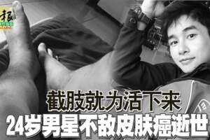 截肢就為活下來24歲男星不敵皮膚癌逝世