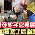 梅豔芳死於子宮頸癌，哥哥長腫瘤，四兄妹三人患癌去世...就是因為吃了這些東西