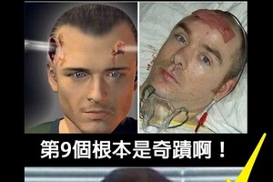 盤點全球不可思議的倖存者！第9個活下來根本是奇蹟！