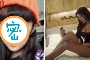 15歲「蛇精女」整形前竟然還比較好看！整形後包養、炫富、整容、小三通通來...艷照『流出』