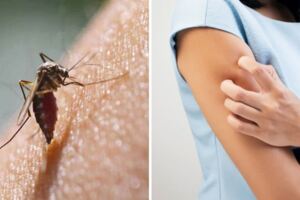 「越善良」越容易被蚊子叮！　實驗發現：牠們從動作判斷你好欺負…