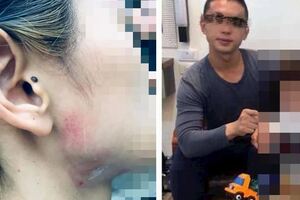 女方懷孕時意見不合被拖行，男方又因服用藥物過量在公共場合直接歐打她，還揚言要同歸於盡！