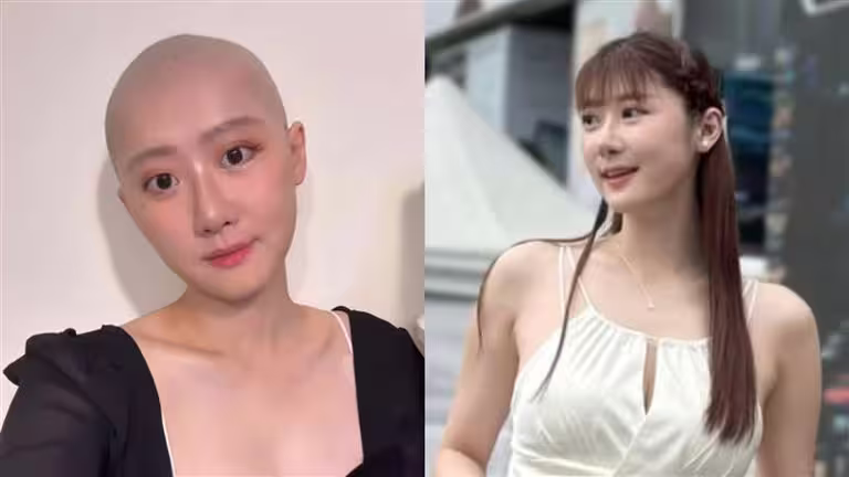 國光女神林茉晶因罹患癌症半年化療六次,副作用掉髮後直接理光頭。(圖/翻攝自林茉晶IG) 國光女神林茉晶因罹患癌症半年化療六次,副作用掉髮後直接理光頭。(圖/翻攝自林茉晶IG)