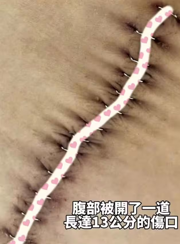 國光女神林茉晶因罹患癌症半年化療六次,副作用掉髮後直接理光頭。(圖/翻攝自林茉晶IG) 國光女神林茉晶因罹患癌症半年化療六次,副作用掉髮後直接理光頭。(圖/翻攝自林茉晶IG)