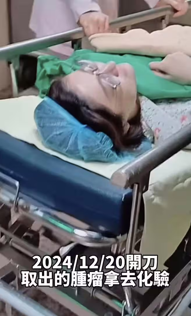 國光女神林茉晶因罹患癌症半年化療六次,副作用掉髮後直接理光頭。(圖/翻攝自林茉晶IG) 國光女神林茉晶因罹患癌症半年化療六次,副作用掉髮後直接理光頭。(圖/翻攝自林茉晶IG)