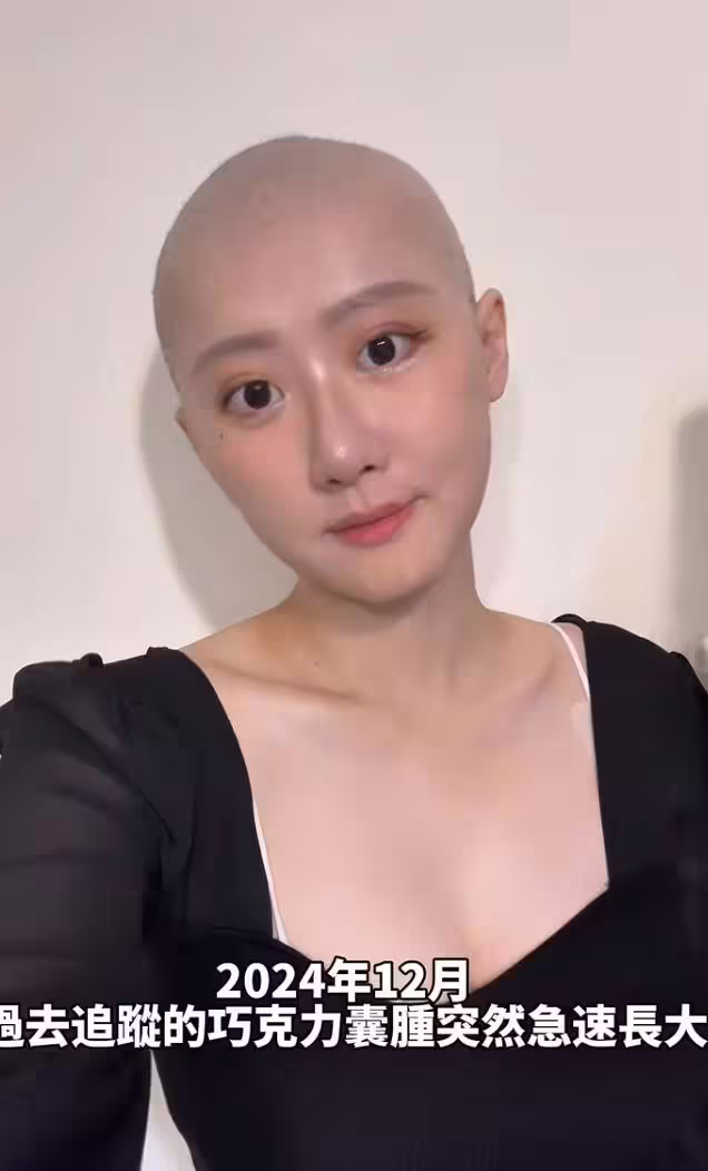 國光女神林茉晶因罹患癌症半年化療六次,副作用掉髮後直接理光頭。(圖/翻攝自林茉晶IG) 國光女神林茉晶因罹患癌症半年化療六次,副作用掉髮後直接理光頭。(圖/翻攝自林茉晶IG)