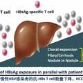 魯鳳民教授：HBeAg陰性患者NA停藥誘發HBsAg陰轉和臨床治癒，我們準備好了嗎？