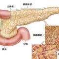 慢性胰腺炎老是反覆發作怎麼辦？肝膽外科手術一招致勝！