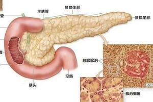 慢性胰腺炎老是反覆發作怎麼辦？肝膽外科手術一招致勝！