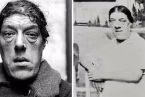 為養活4子女！媽媽忍痛參加「選醜大賽」奪冠　「年輕時美貌曝光」背後經歷超鼻酸