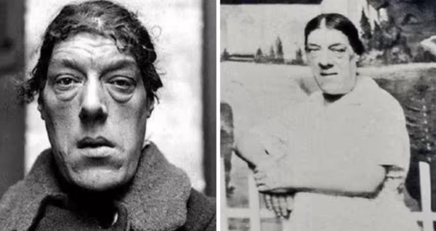 為養活4子女!媽媽忍痛參加「選醜大賽」奪冠 「年輕時美貌曝光」背後經歷超鼻酸