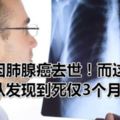 女星因肺腺癌去世！而這一種癌症從發現到死僅3個月