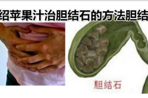 介紹蘋果汁治膽結石的方法膽結石的治療方法主要有：、保守治療、非手術治療等