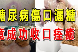 糖尿病傷口灑糖，竟成功收口痊癒？