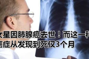 女星因肺腺癌去世！而這一種癌症從發現到死僅3個月